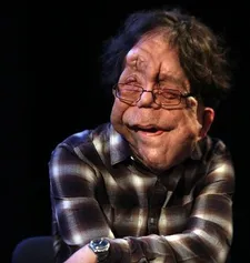 Adam Pearson talks Chained For Life