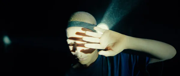 The Boy With White Skin
