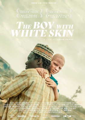 The Boy With White Skin packshot